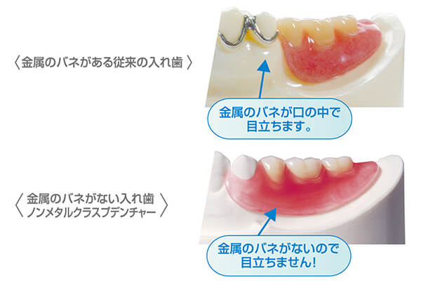 入れ歯